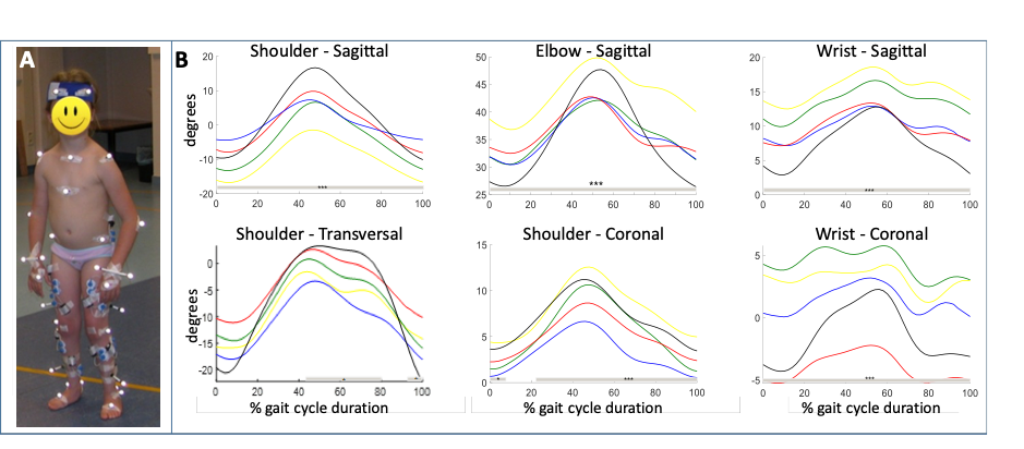 Maturation Of Arm Swing During Walking Ispgr Org