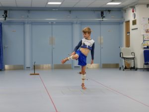 Example of clinical movement analysis