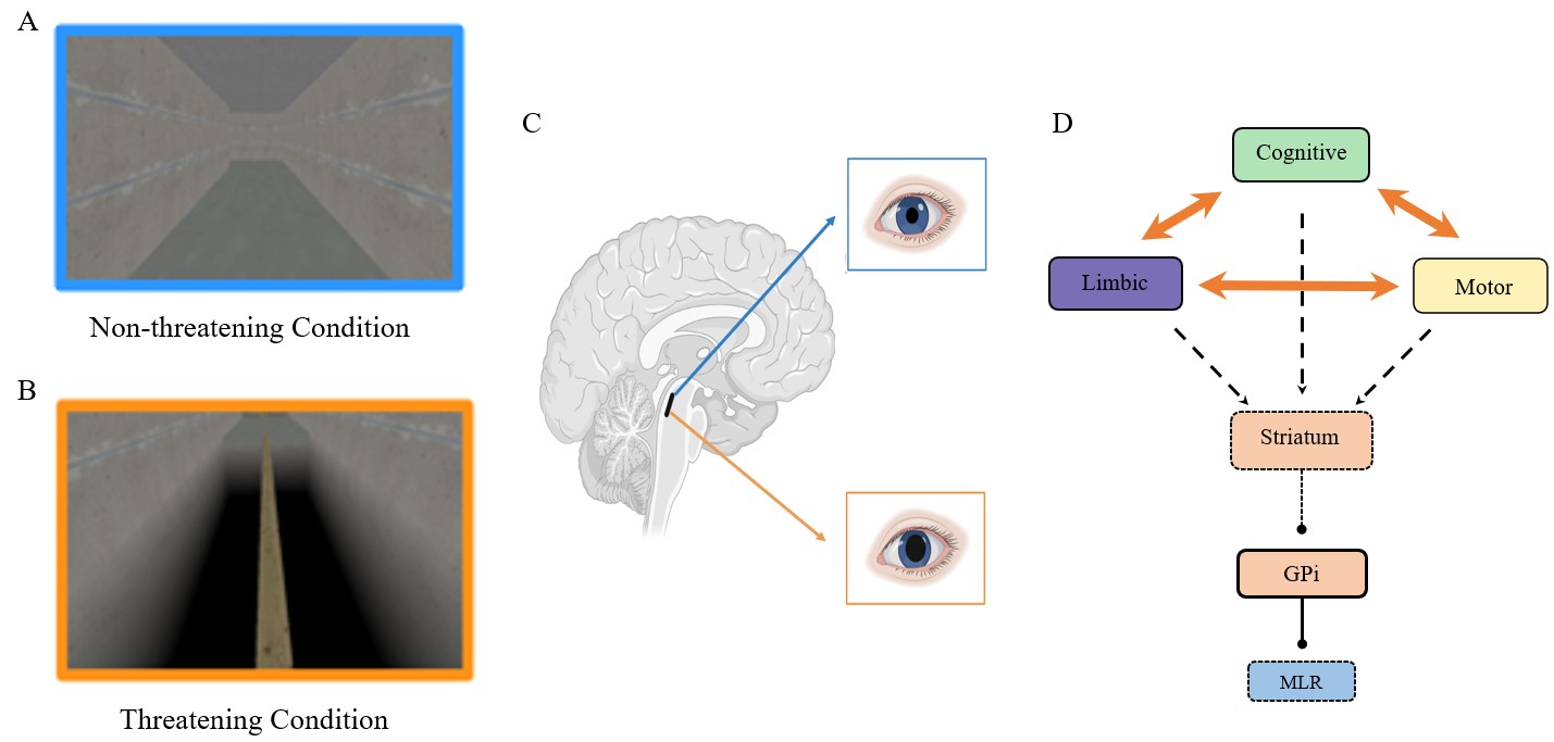 How does anxiety ‘set the stage’ for Freezing of Gait? - ISPGR